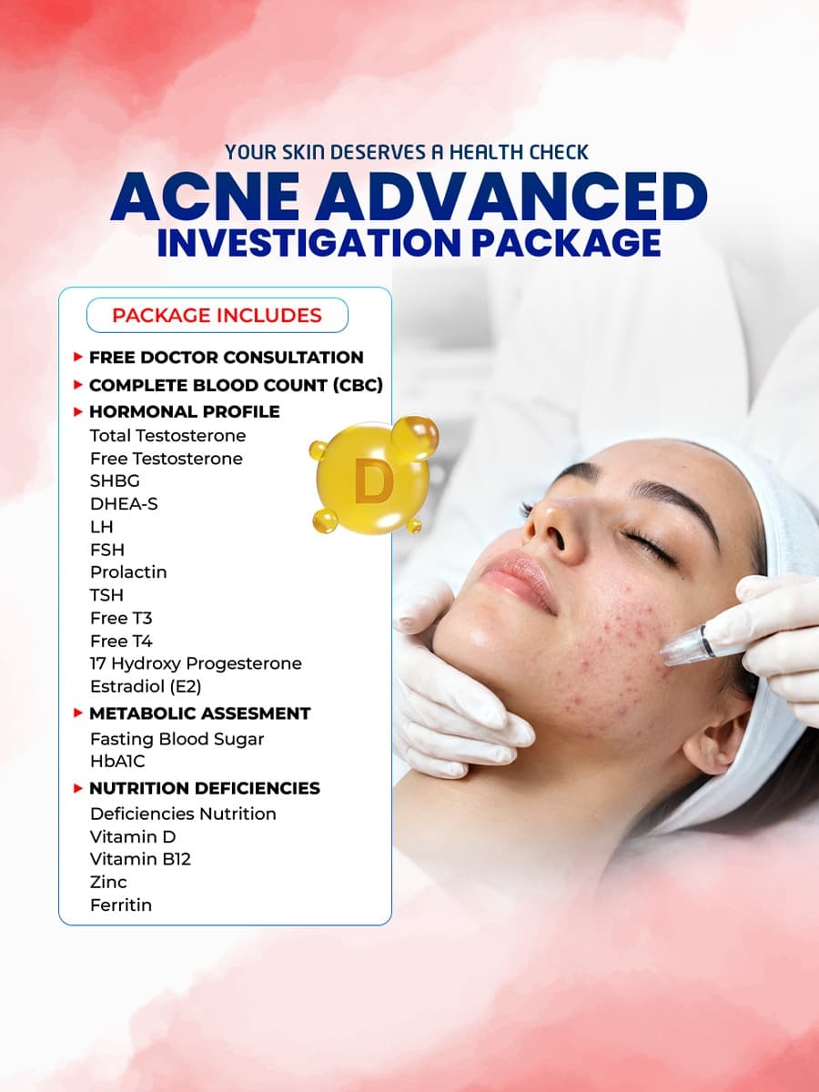 Acne Advanced Investigation Package